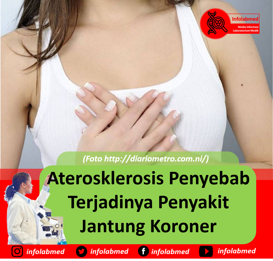 Aterosklerosis Penyebab Terjadinya Penyakit Jantung Koroner | Info