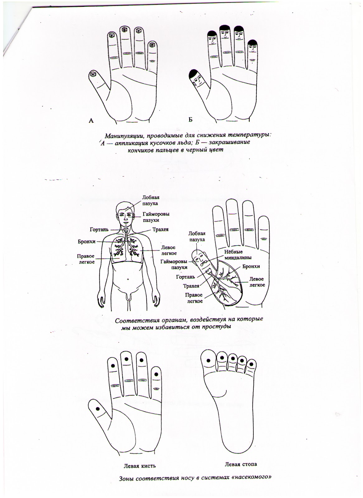 точки су джок при простуде. точки акупунктуры от повышенного давления. акупунктурные точки от кашля для детей. точечный массаж при. дренажный массаж при пневмонии у детей.