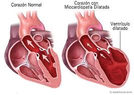 cardiopatia congenita