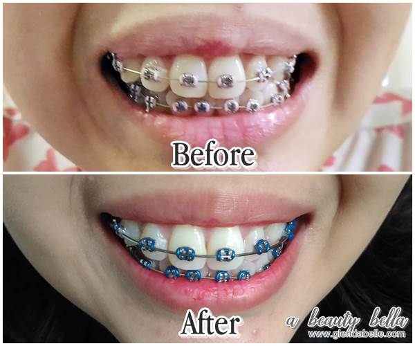 AP24 Whitening Fluoride Toothpaste Review A Beauty Bella