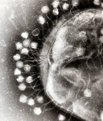 Viral diseases in humans