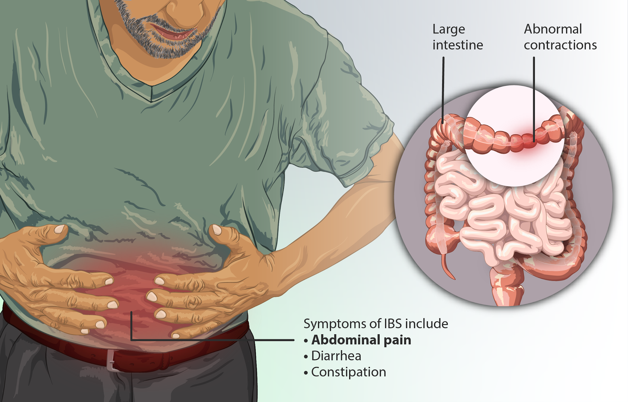 Hinchazón intestinal