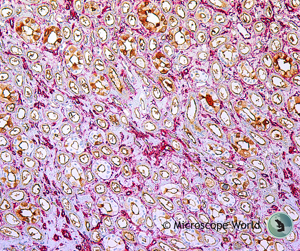 Microscope World Blog Understanding Kidney Disease in Dogs