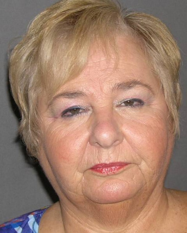 Benchmark Capital Investigation Arrests Begin