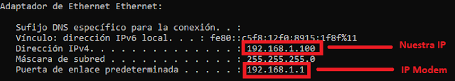 IP Modem Cantv DHCP