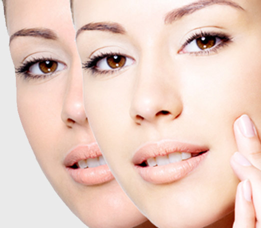 Natural Bleach For Skin Lightening Natural Bleach For Skin Lightening