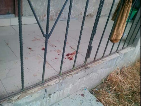 Photos: AIT staff fighting for her life in Bayelsa after being robbed and shot at close range on her way home from Shiloh