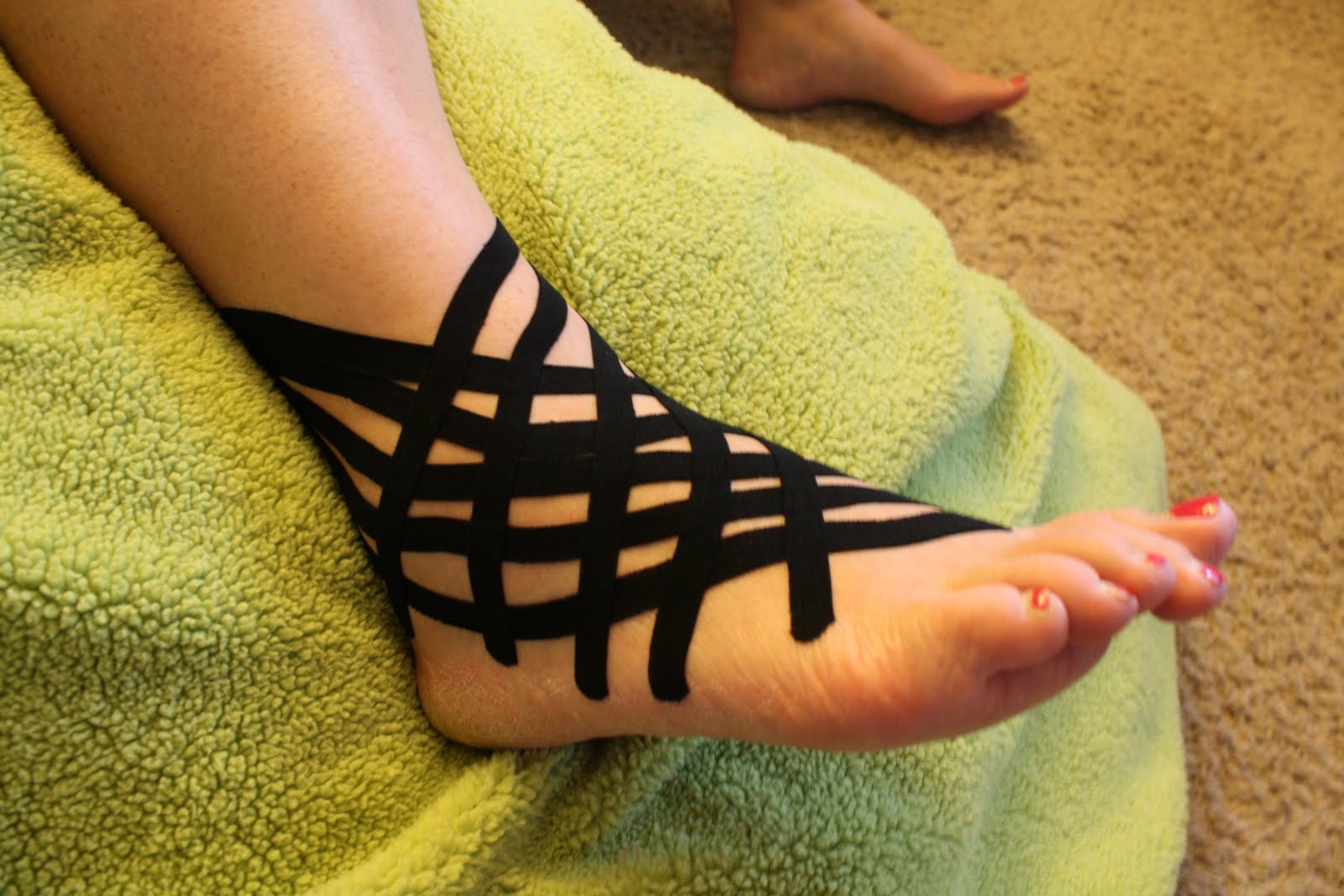 Dr. Bryon's Health Blog Lateral Ankle Sprain Reducing Swelling and