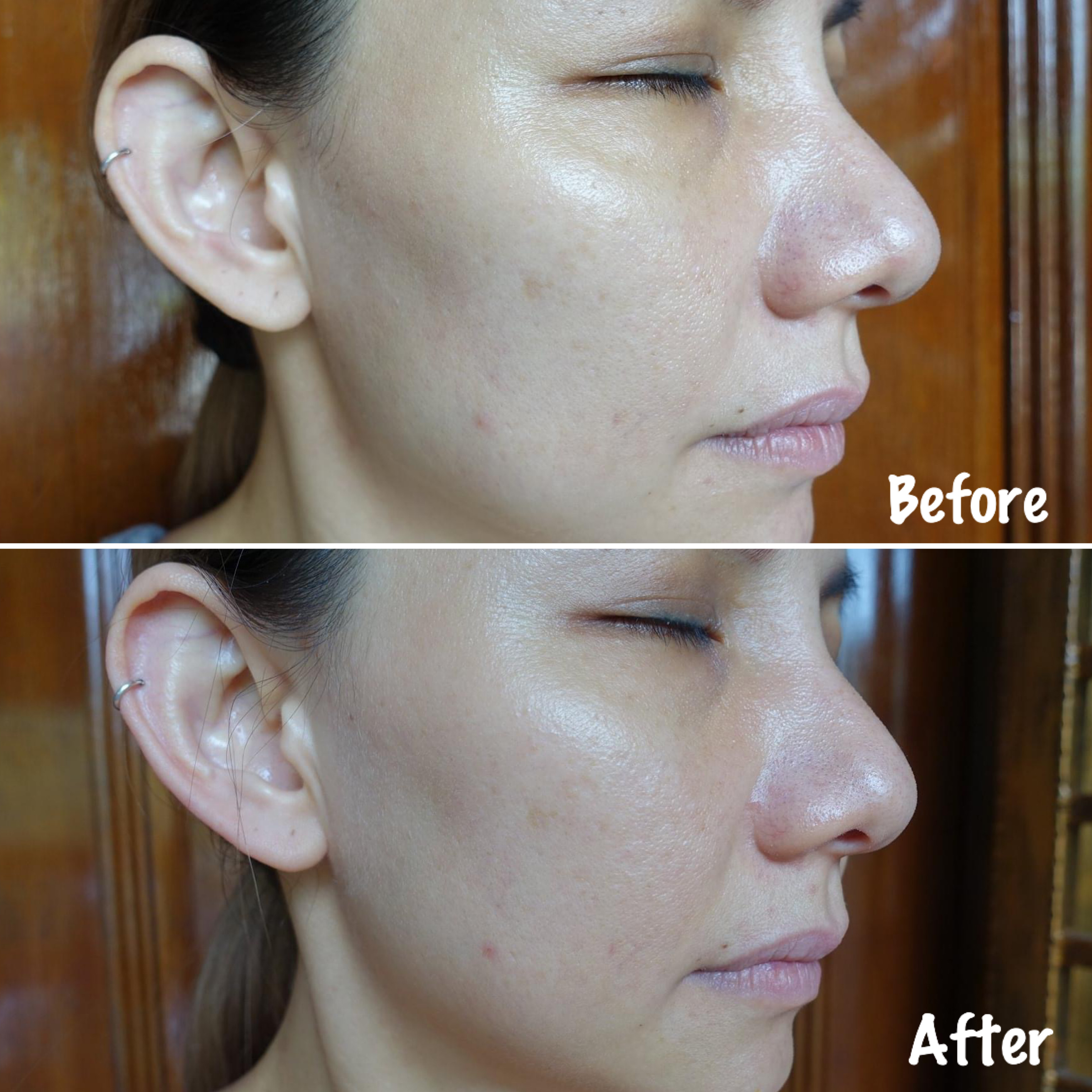 murad glycolic vitamin c serum