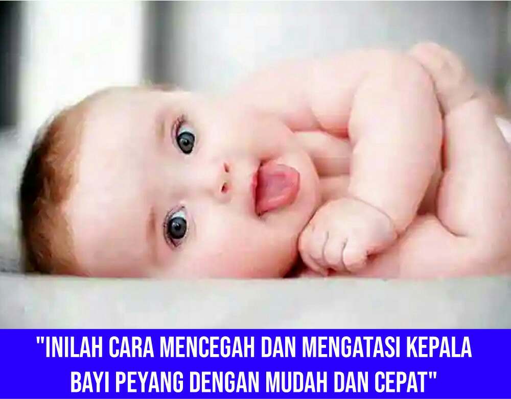 Cara Mengatasi Kepala Peyang Pada Bayi 4 Bulan Kompas Sekolah