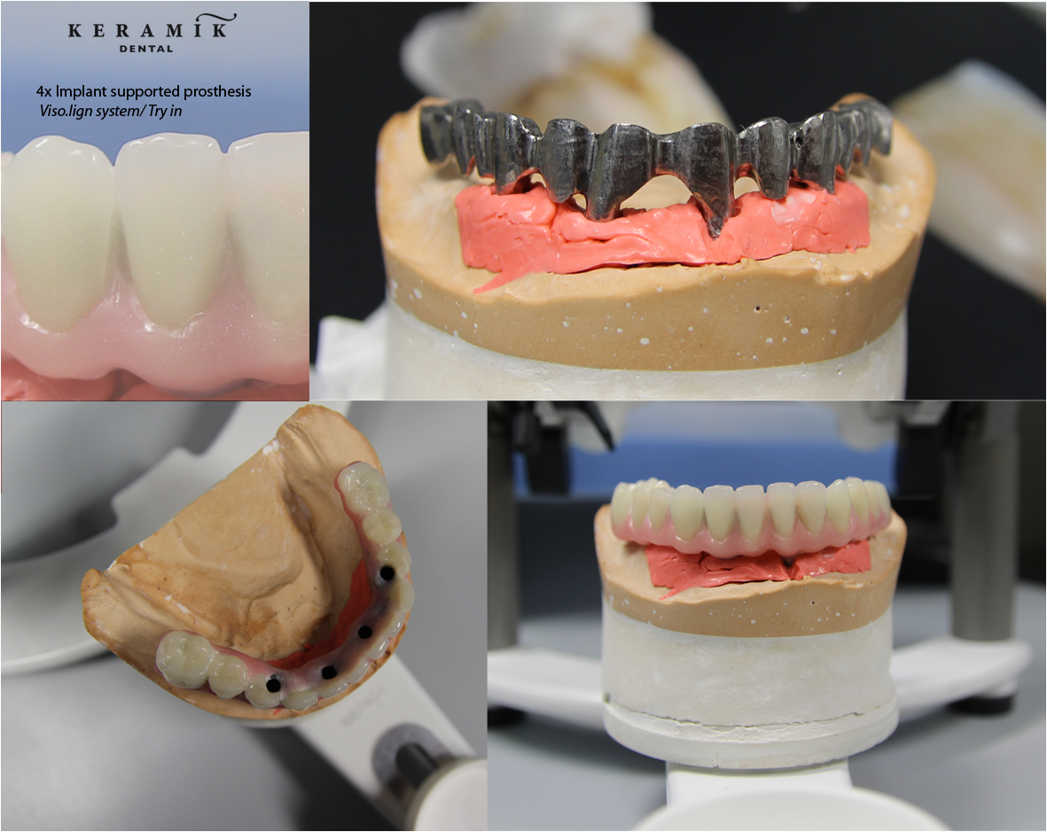 KERAMIK DENTAL LABORATORY