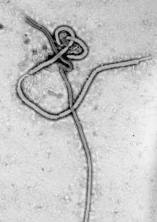 Virus do ébola