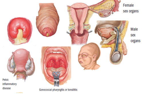 Jual Obat Sipilis De Nature Pengiriman ke Sukabumi