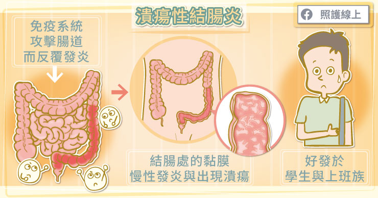 潰瘍 性 大腸 炎 食事