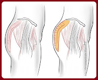chirurgia-glutei-forma darospoaprincipe
