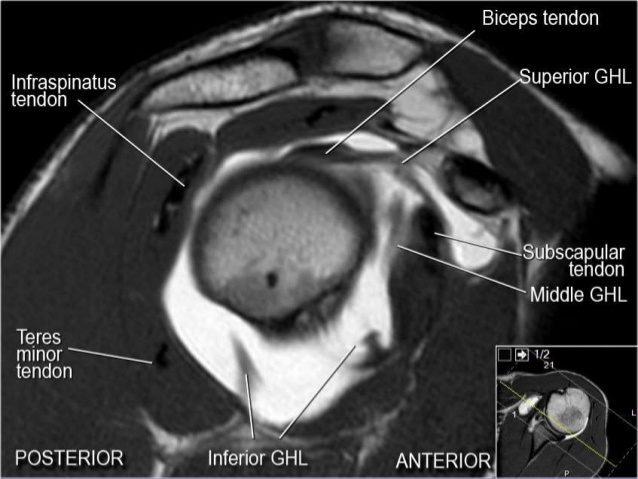 MRI Musculo-Skeletal Section: MRI anatomy of the shoulder (sagittal view).