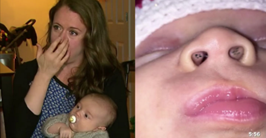 Alors qu'elle allaite son enfant, cette mère découvre de petites taches noires dans son nez. Elle fait vite le rapprochement.