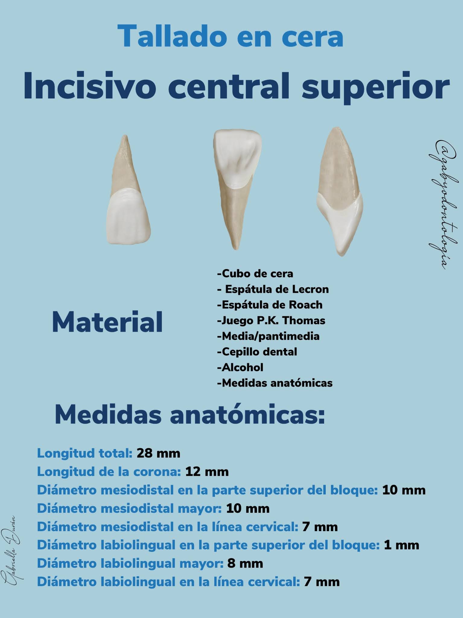 Incisivo central superior 3D model by Juan I. Cruz R. Smart Anatomy ® (juigcrra) [70f1b0e