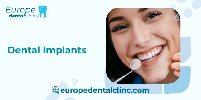 Dental Implants - Europe Dental Clinic