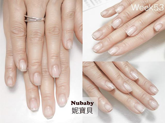 指甲矯正-甲型微調 重新處理撕剝摳咬的問題指甲 指甲矯正-甲型微調 重新處理撕剝摳咬的問題指甲