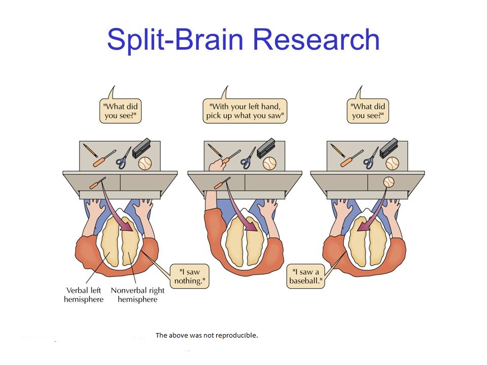 split brain patients