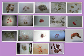 JAMU SUSUK DARA: TESTIMONI JAMU PENGANTIN DARA