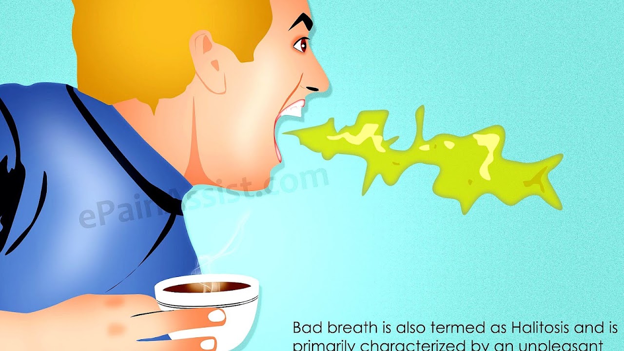 Treatment For Bad Breath Caused By Acid Reflux Treat Choices
