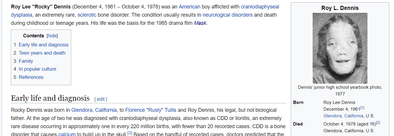 The Mindless Freaks: Rocky Dennis-Mask and the new film "Wonder"