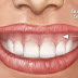 Chữa cười hở lợi không phẫu thuật bằng cách tiêm chất botox