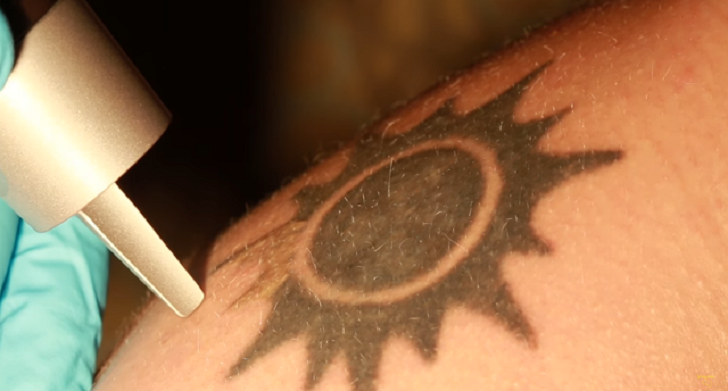 Skin Paintings (Tattoos) Can Be Dangerous to Your Health - HEALTH GUIDE 911