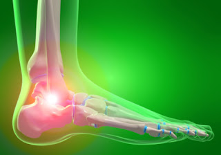 Symptoms and Causes of High Uric Acid Levels