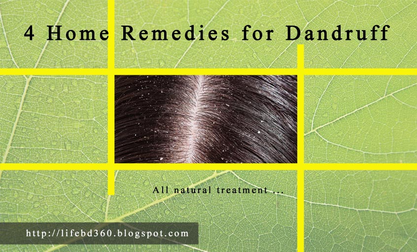 How To Apply Coconut Oil To Remove Dandruff And Stop Hair Loss Apply