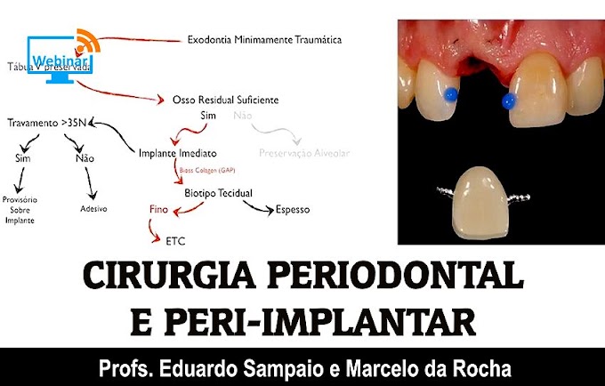 CIRURGIA PERIODONTAL: Imersão em Cirurgia Tecidual Estética Periodontal e Peri-implantar - Profs. Eduardo Sampaio e Marcelo da Rocha