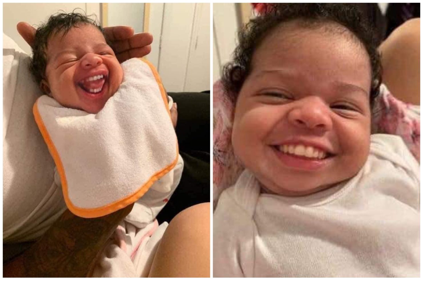 Baby Born With Complete Set Of Teeth SEE PHOTOS I