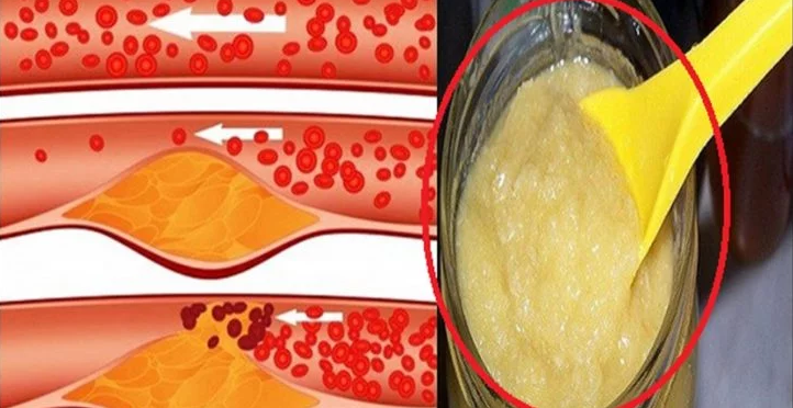 is diet soda bad for your kidneys