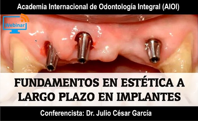 WEBINAR: Fundamentos en estética a largo plazo en implantes - Dr. Julio César García