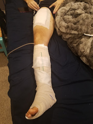 Skin Graft Surgery 9/14/2020