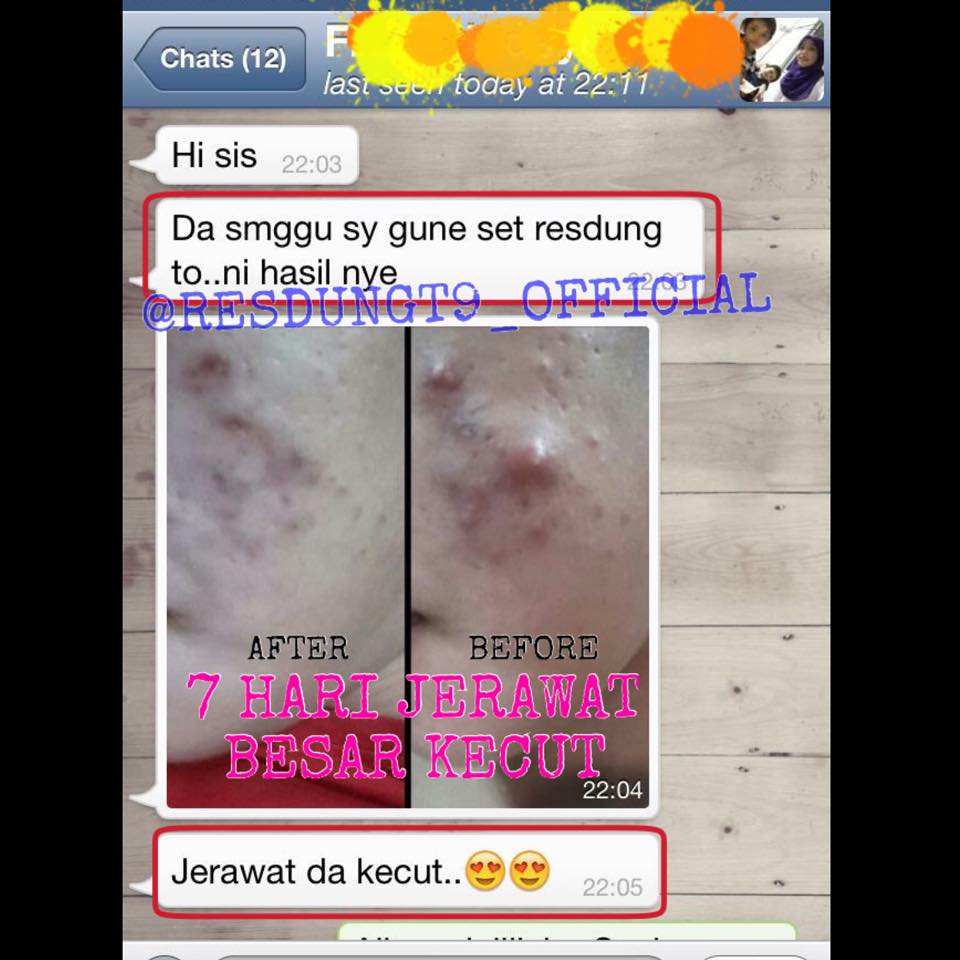 Ubat Paling Mujarab Untuk Panau  Contoh Mulan