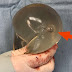 Woman's Breast Implant Saved Her Life by Deflecting a Bullet, Case Study Shows
