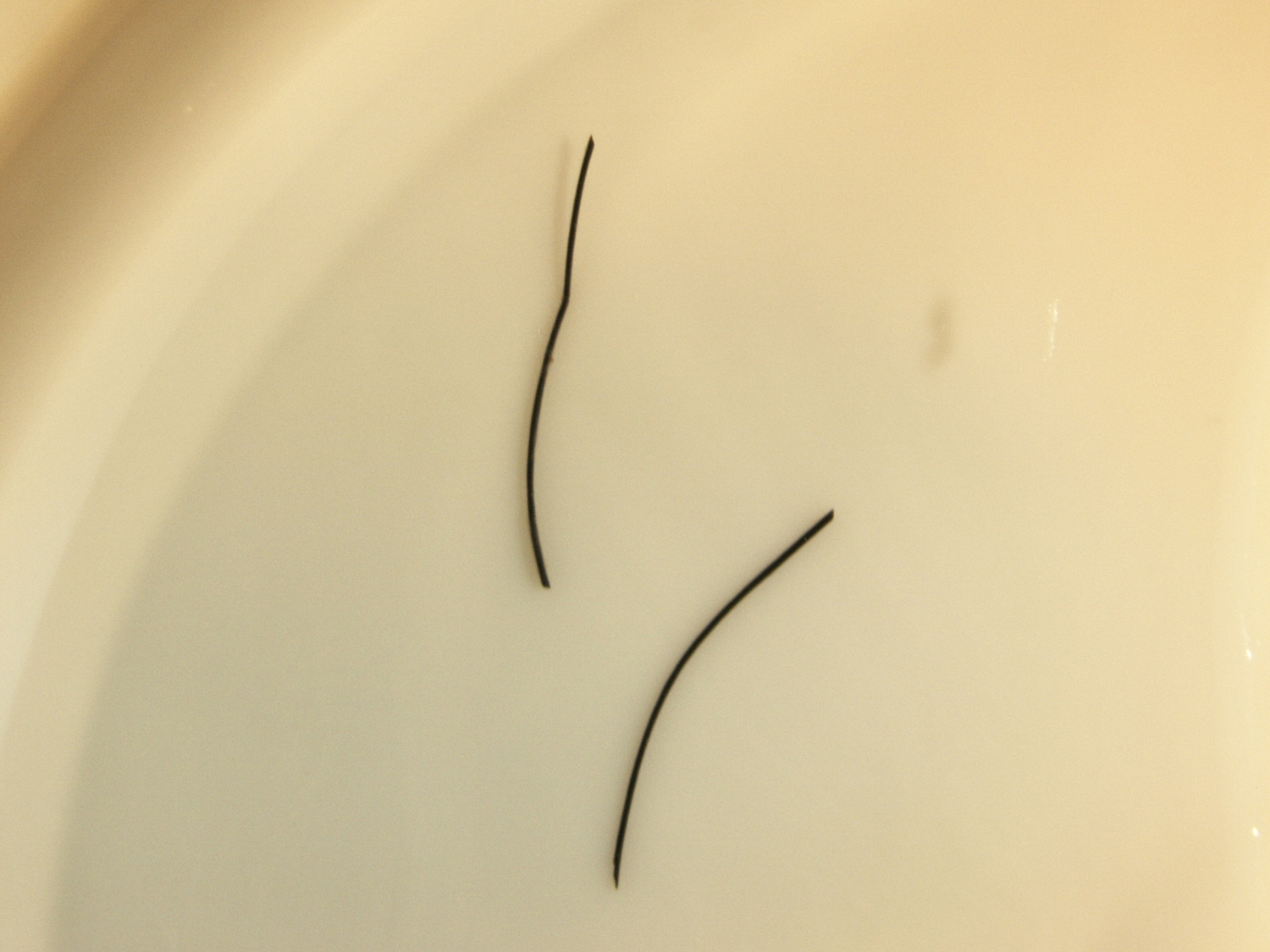 Creepy Dreadful Wonderful Parasites Answer to Case 435