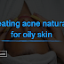 Treating acne naturally for oily skin Treating acne naturally for oily skin