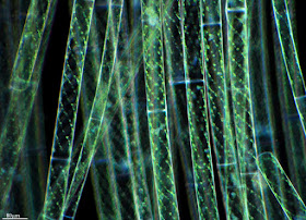 Spirogyra - Chlorophyceae