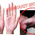 Beli obat eksim Herbal di apotik medan thumbnail