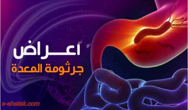 اعراض جرثومة المعدة اعراض جرثومة المعدة