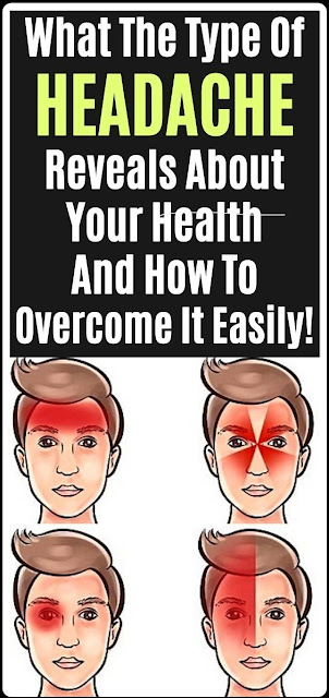 This is How Headaches Reveal What is Wrong With Your Health (And How To ...