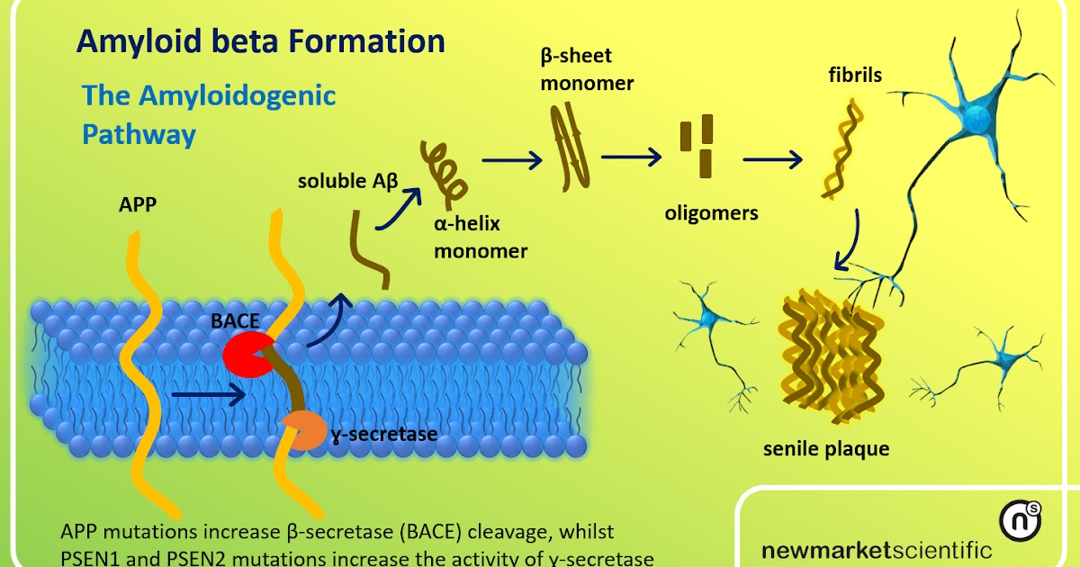 Newmarket Scientific Short Article on Alzheimer’s Disease 1 Amyloid