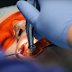 Имплантация зубов: искусство красивой улыбки