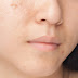 8 Best Effective Healthy Glowy Skin Care Tips