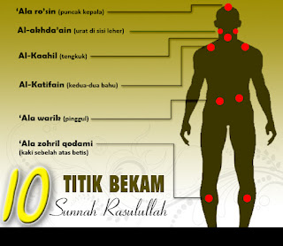 TENTERA BERKUDA: TITIK - TITIK BEKAM UTAMA ( BEKAM SUNNAH )