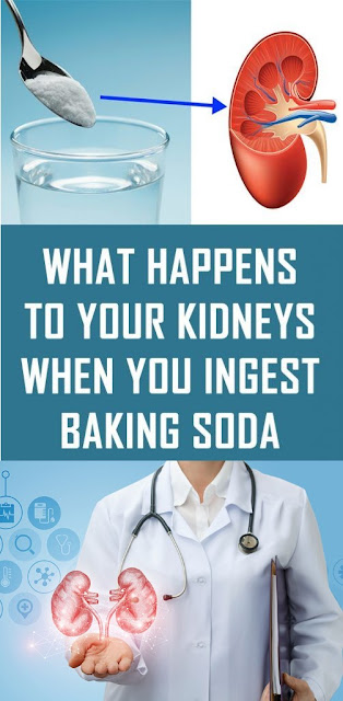 What Happens to Your Kidneys When You Ingest Baking Soda - Healthy Lifestyle